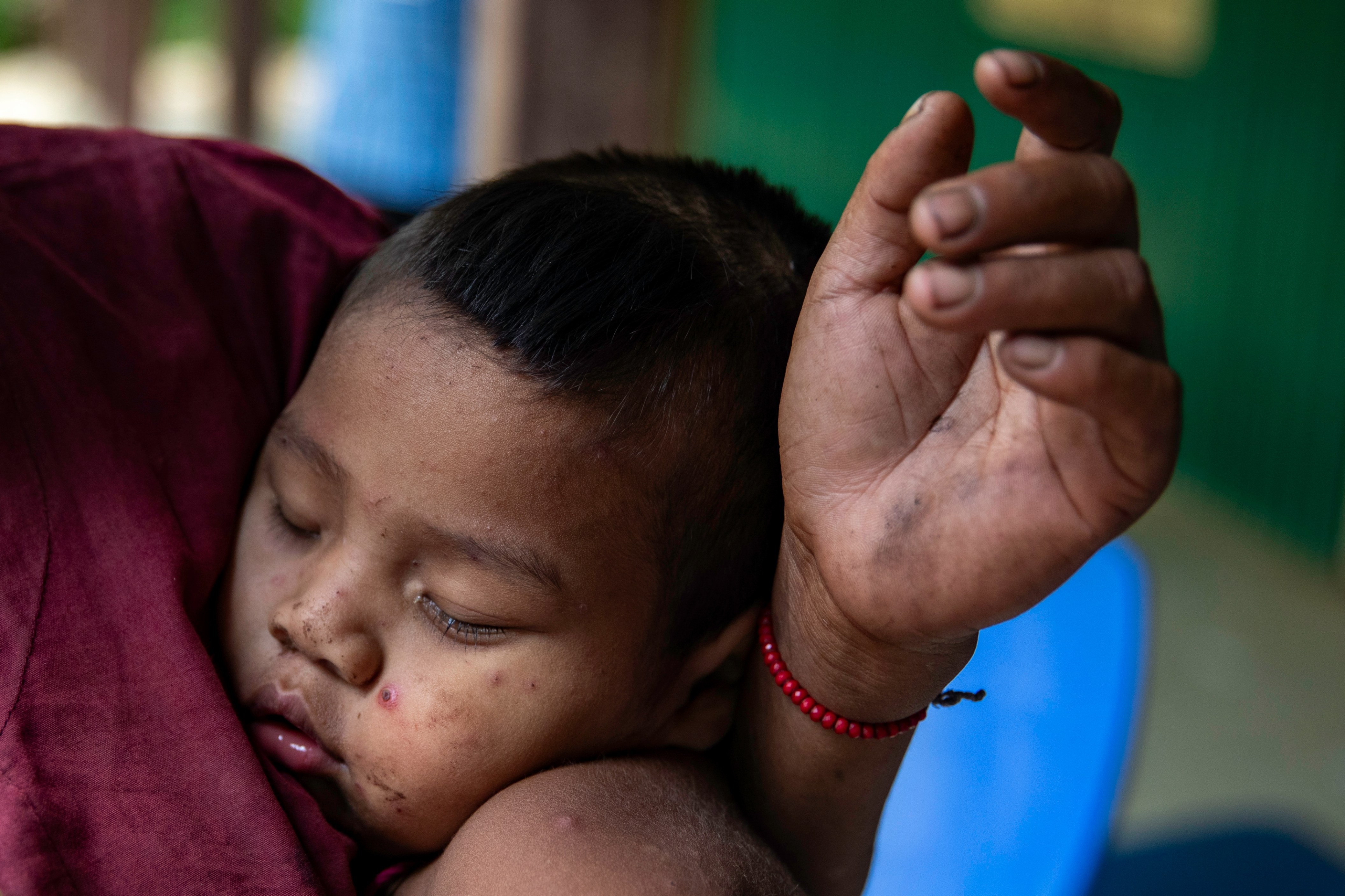 The Mro children who could not reach the vaccine