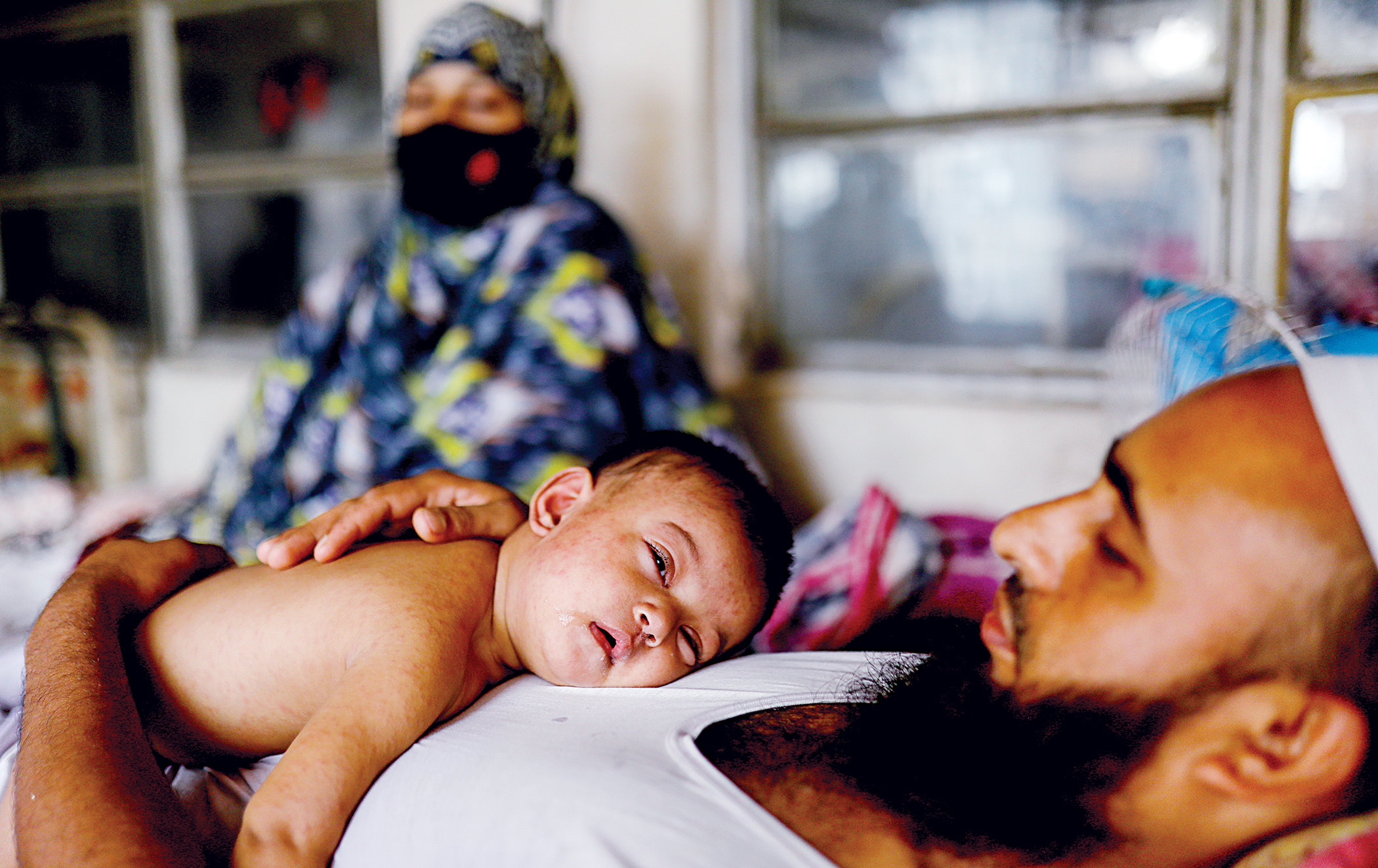 DGHS revises data on measles outbreak again