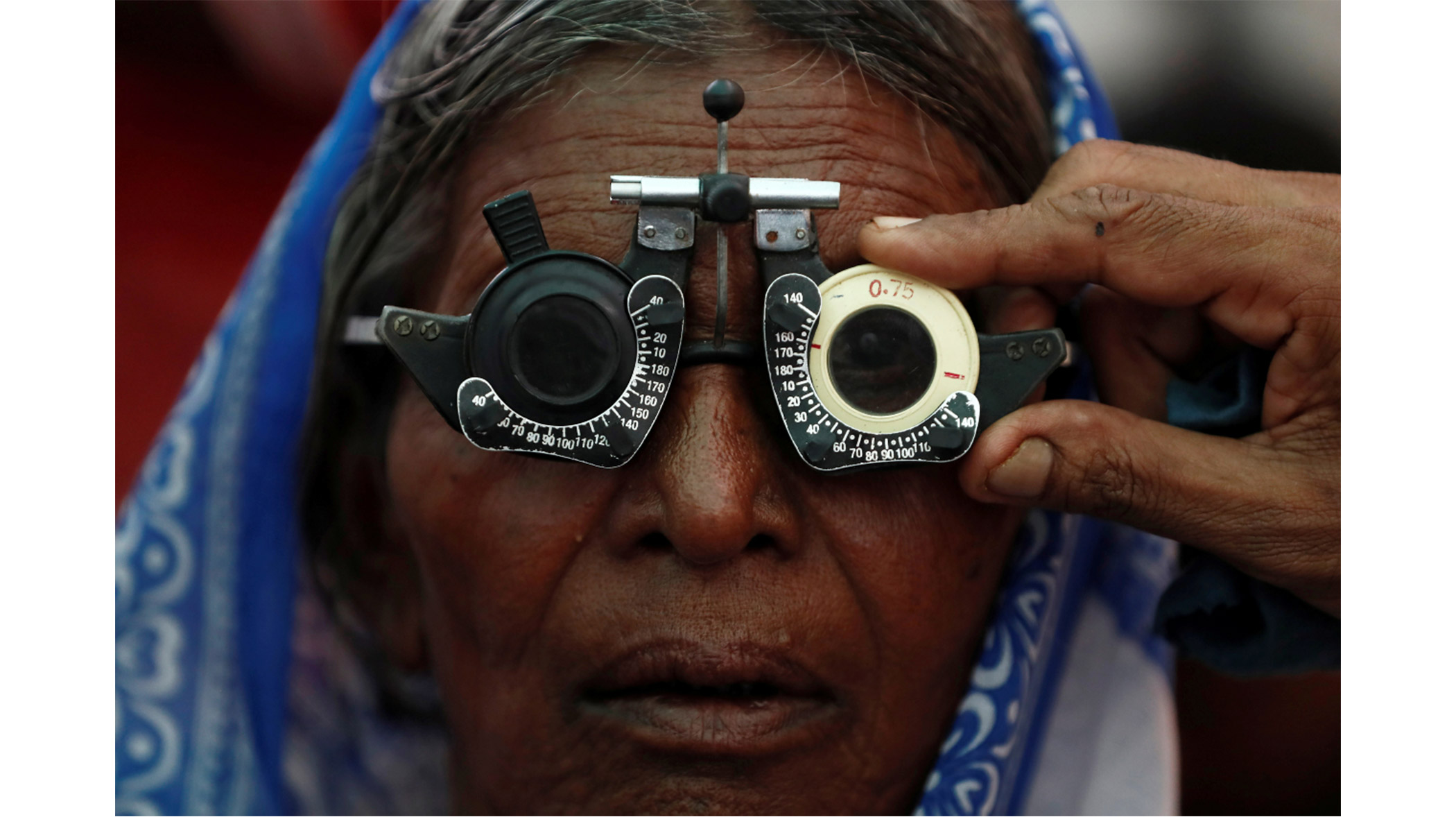 Stop diabetic retinopathy before it starts
