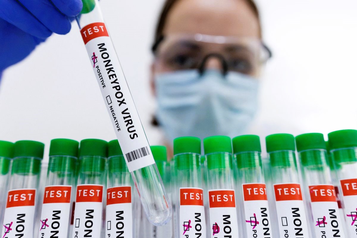 Monkeypox cases in Europe tripled in last 2 weeks, says WHO
