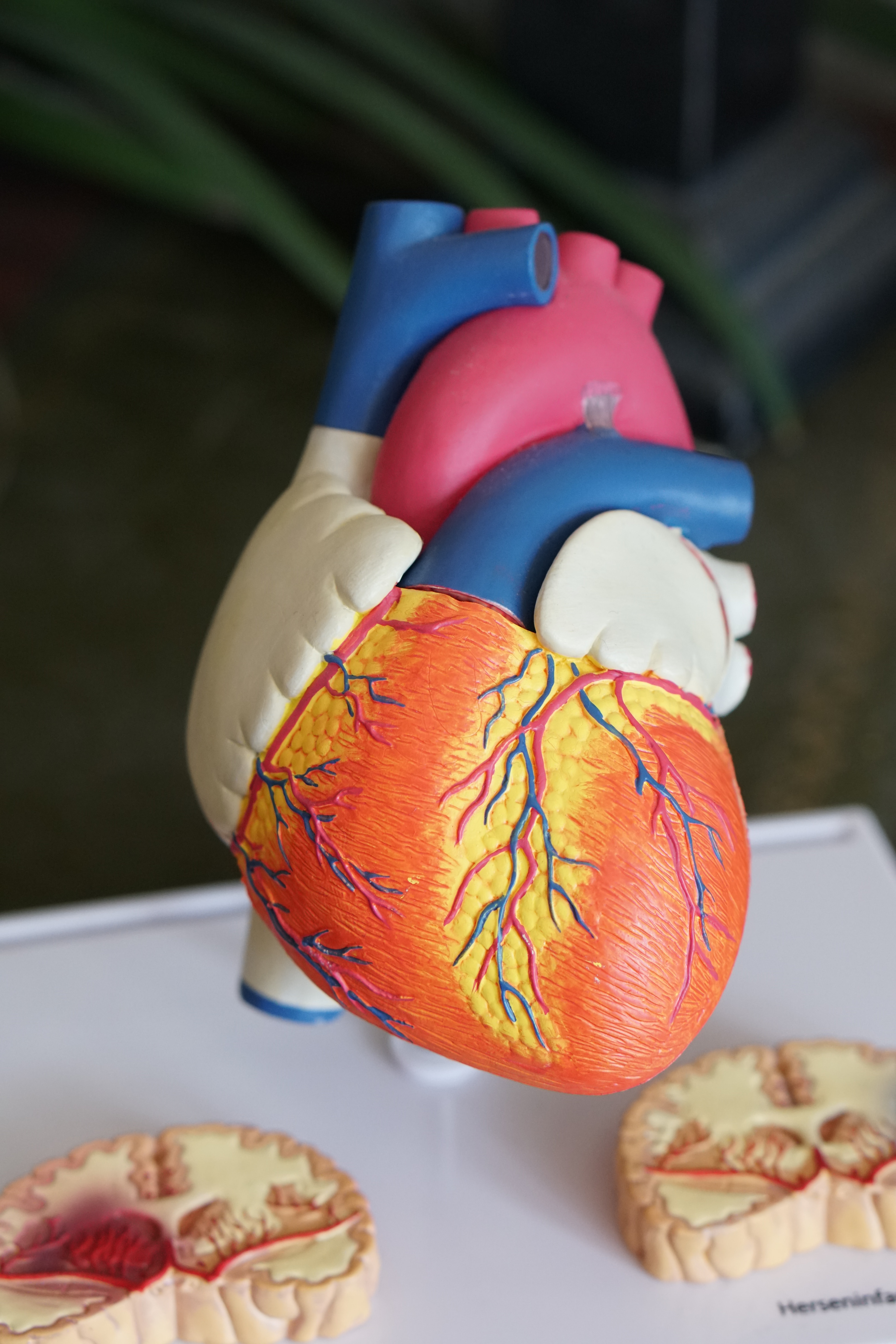 Government slashes prices of heart rings
