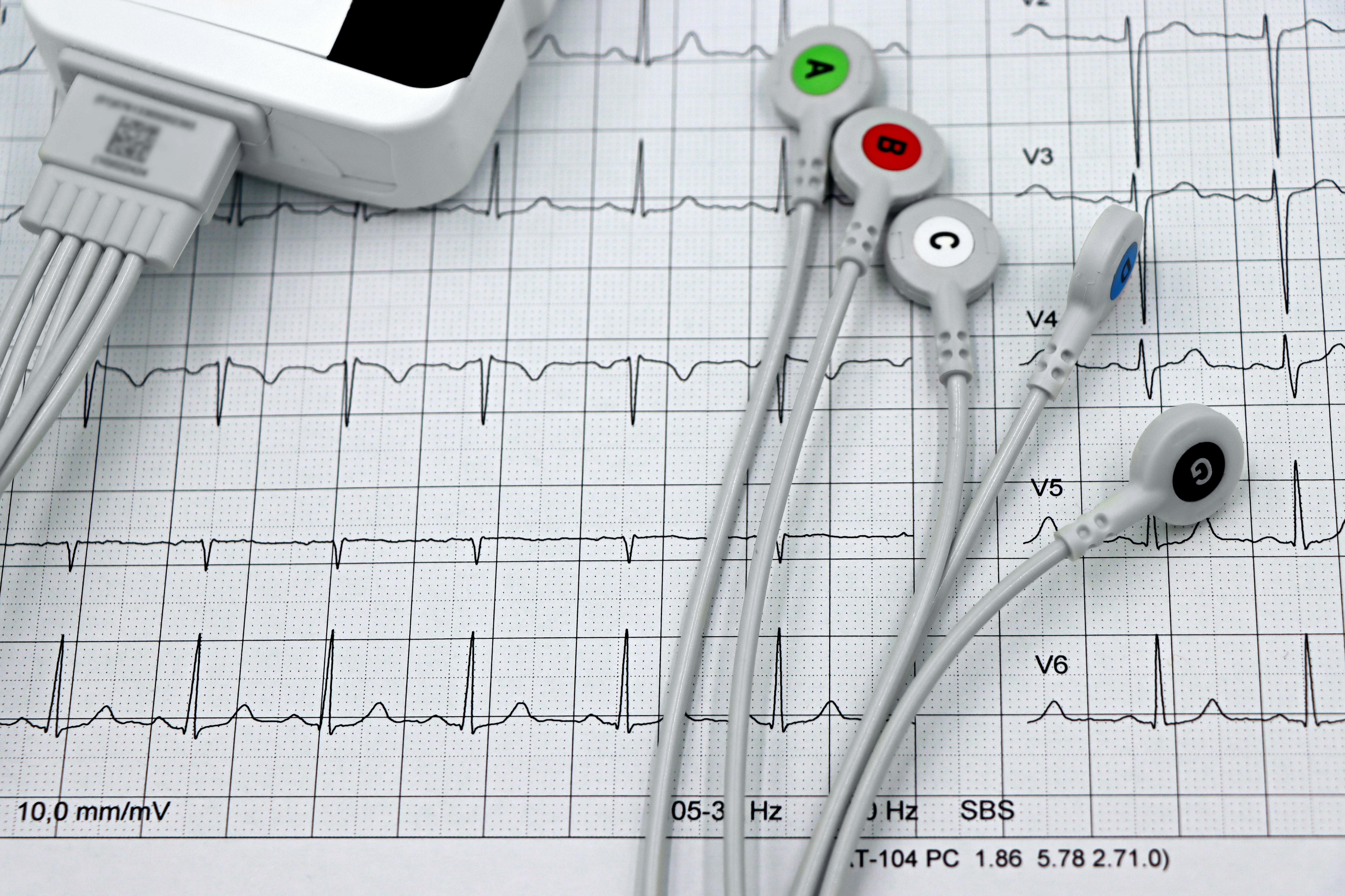 Early signs of heart attack: What every Bangladeshi should know