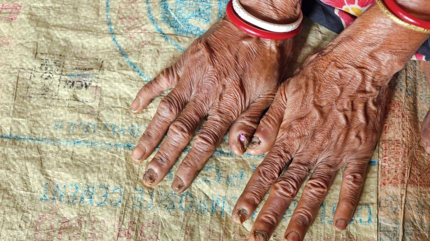 Climate-sensitive diseases can move beyond old categories of urban and rural, seasonal and exceptional.