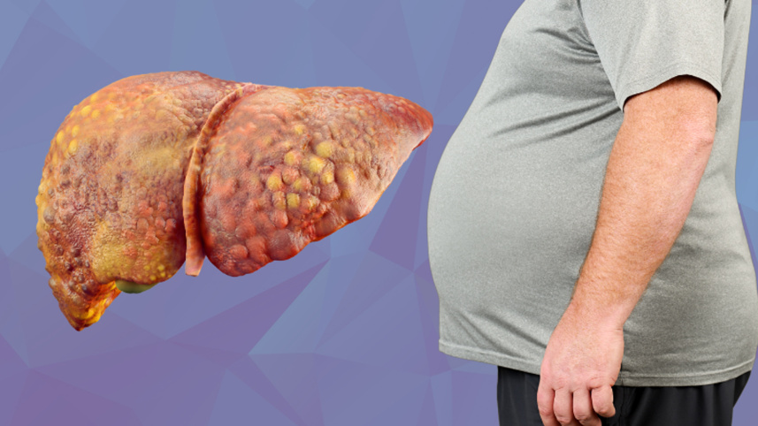fatty-liver-disease.jpg