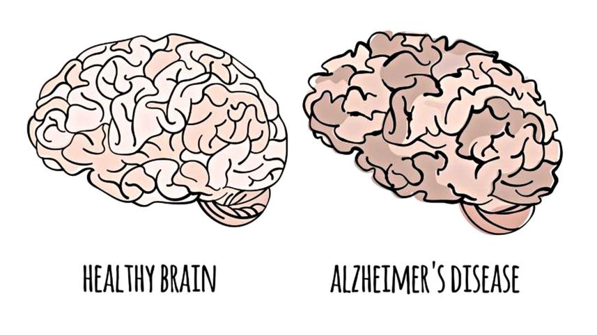 brain.jpg