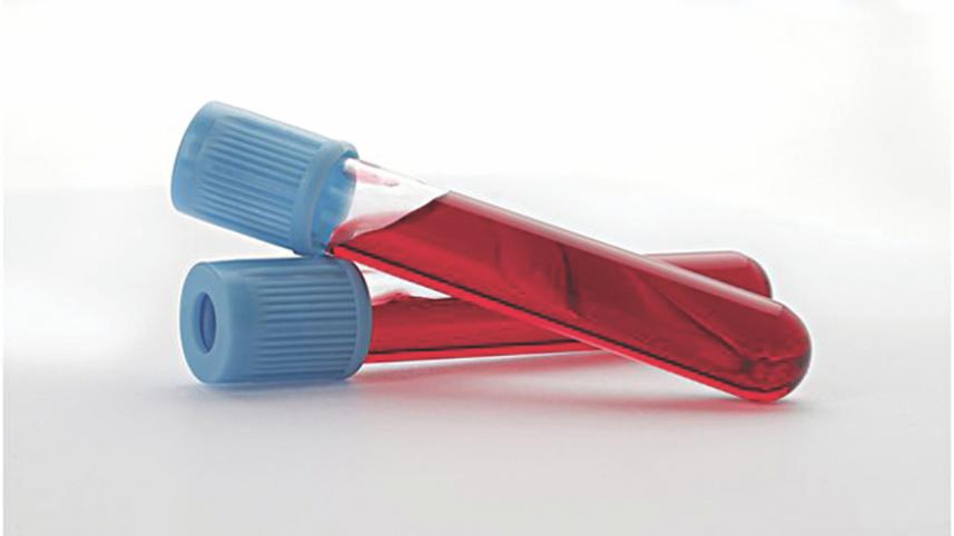 blood test.jpg