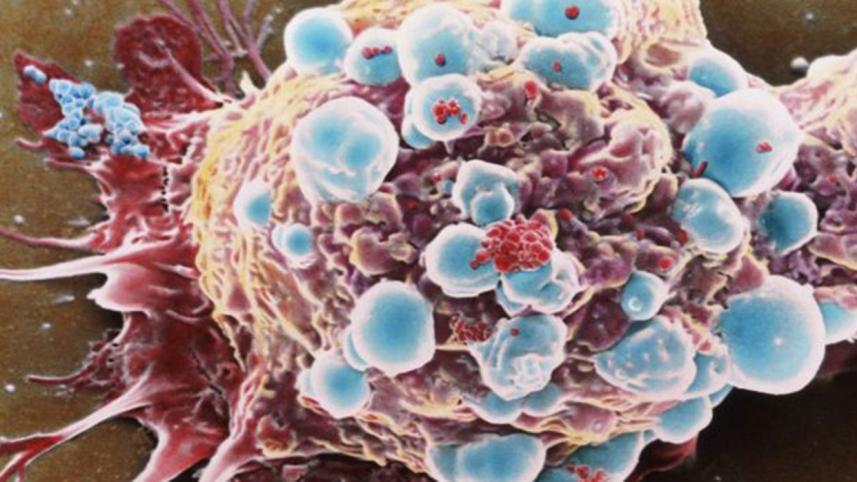 cancer_cell-spl-1-web.jpg