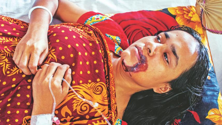 dowry torture.jpg