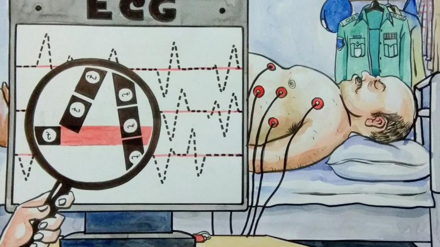 ECG.jpg