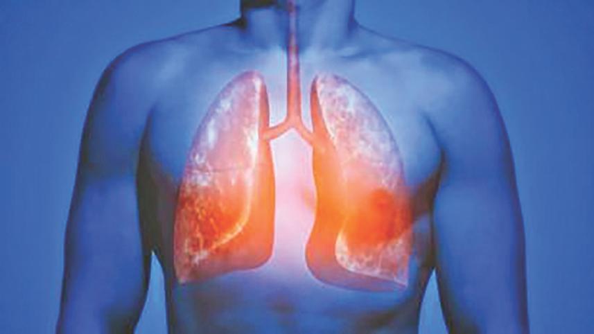 lungs.jpg