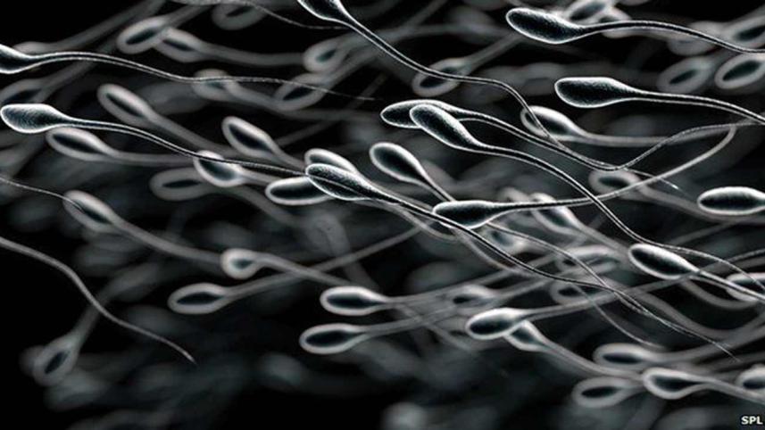 Sperm.jpg