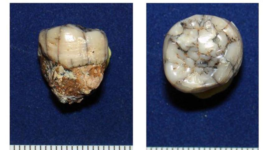 TEETH-WB.jpg