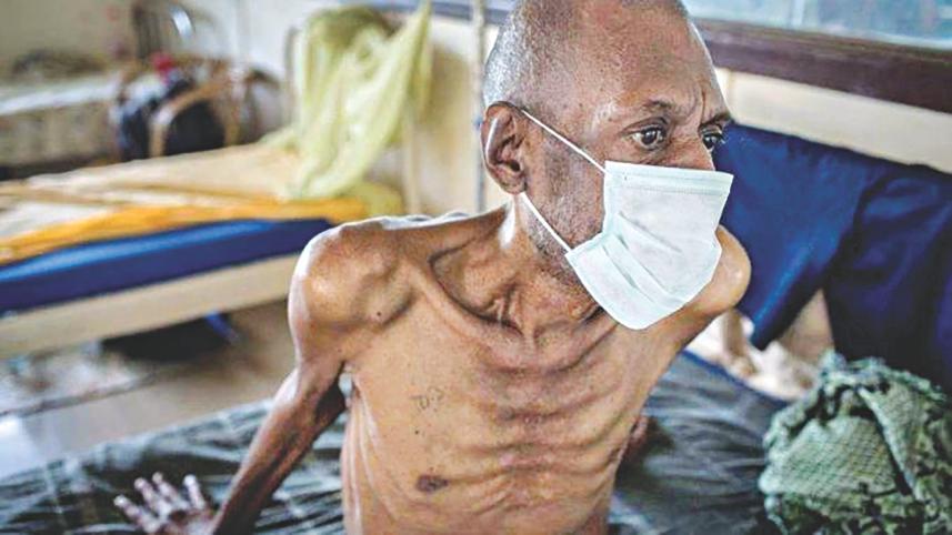 tuberculosis.jpg