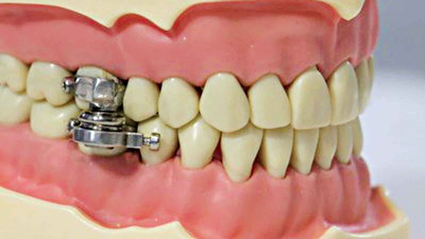 teeth.jpg