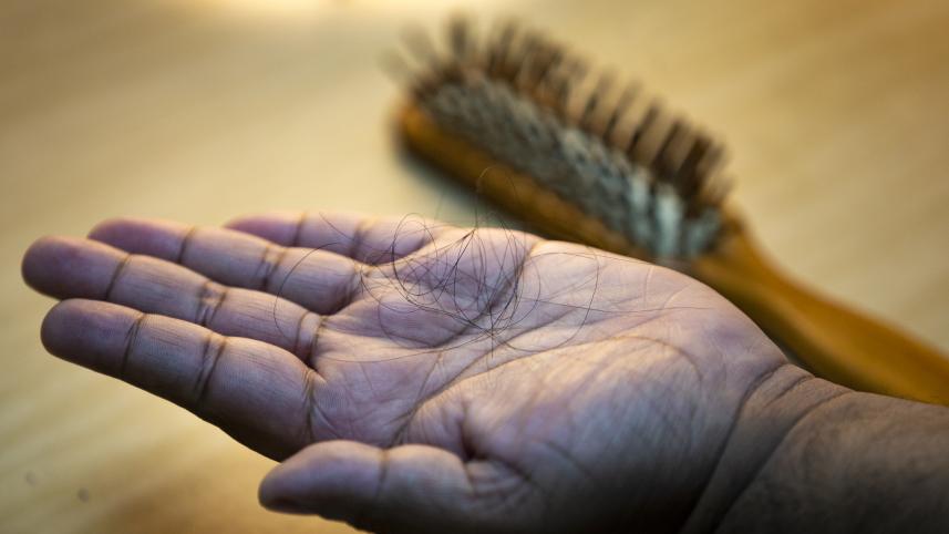 Stray hair on palm indication hairloss
