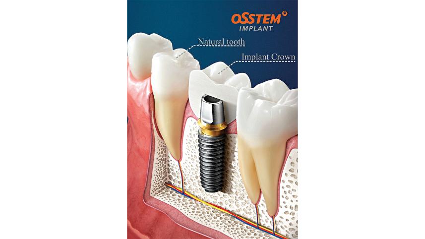 tooth.jpg