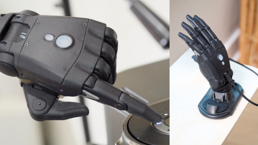 Bionic arm