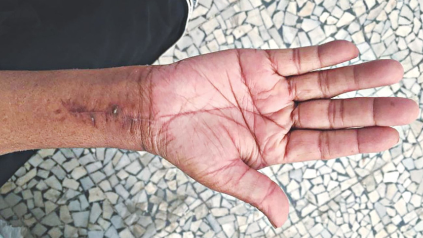 hand