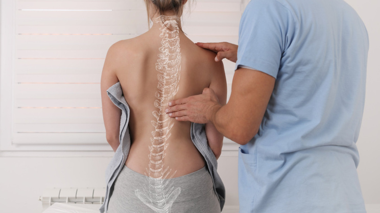 Scoliosis