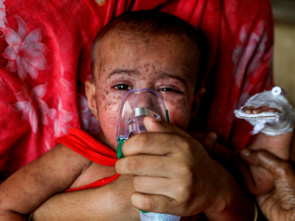 measles outbreak in Bangladesh.jpg