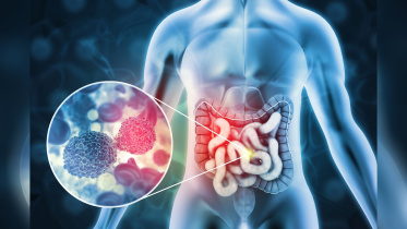 cancer-battle-01.jpg