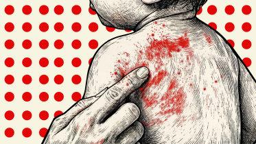 Bangladesh measles vaccine crisis investigation