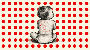 measles deaths in Bangladesh 2026 update