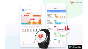 Cardiogram