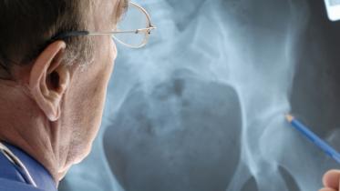 osteoporosis-related bone fractures