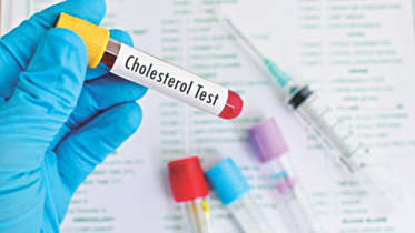lipid tests.jpg