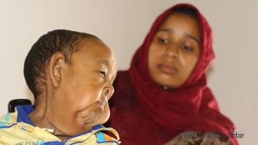 Senile Kid Bayezid, Progeria