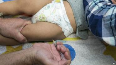 rubella-NWB.jpg