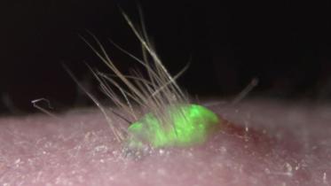 Skin-1WB.jpg