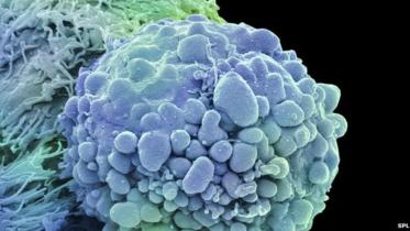 Softener-kills-cancer.jpg