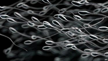 Sperm.jpg