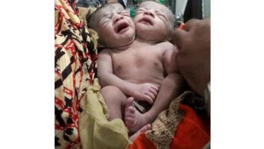 two-headed-baby-web-new.jpg