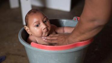 Zika virus-2.jpg