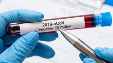 test_coronavirus-positive_0_0_1.jpg