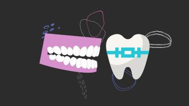 dental_brace.jpg