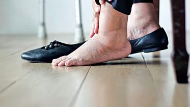 swollen.jpg