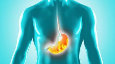 Peptic Ulcer Treatment