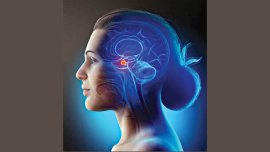 repeat-mri-scans.jpg